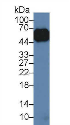 Polyclonal Antibody to Alpha-1-Acid Glycoprotein (a1AGP)