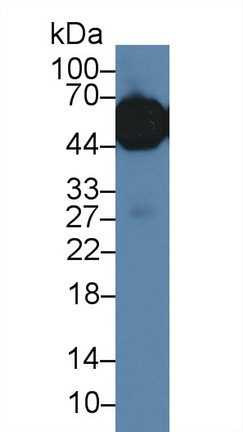 Polyclonal Antibody to Alpha-1-Acid Glycoprotein (a1AGP)