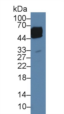 Polyclonal Antibody to Alpha-1-Acid Glycoprotein (a1AGP)