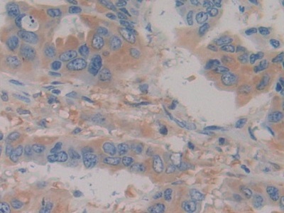 Polyclonal Antibody to Haptoglobin (Hpt)