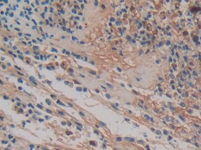 Polyclonal Antibody to Haptoglobin (Hpt)