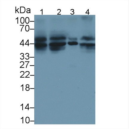 Polyclonal Antibody to Death receptor 5 (DR5)