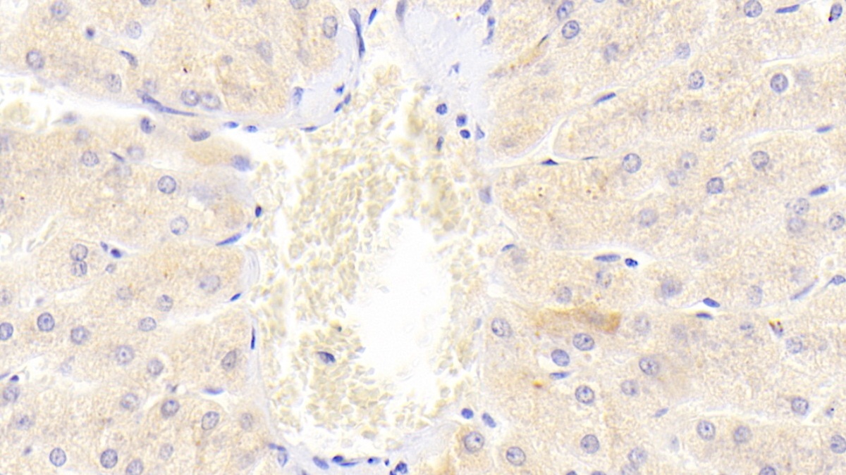 Polyclonal Antibody to Death receptor 5 (DR5)