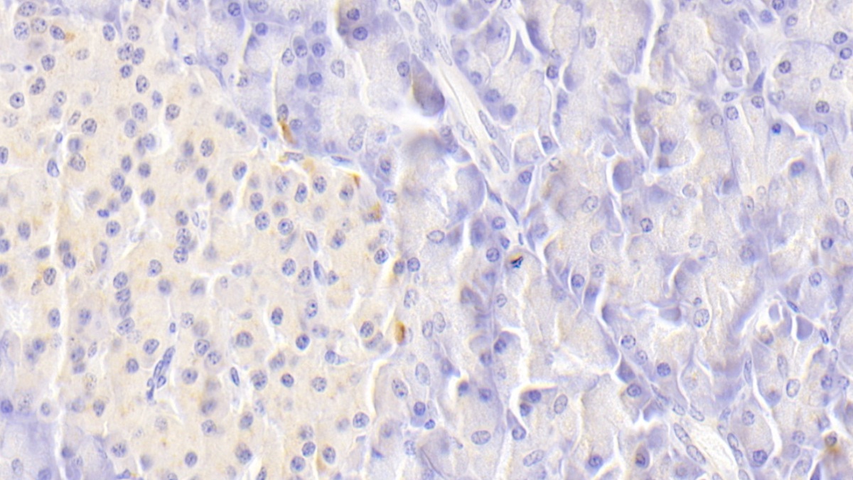Polyclonal Antibody to Death receptor 5 (DR5)