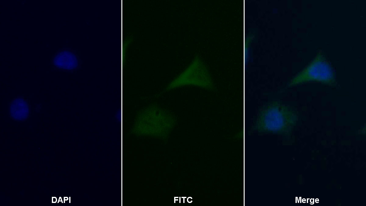 Polyclonal Antibody to Death receptor 5 (DR5)