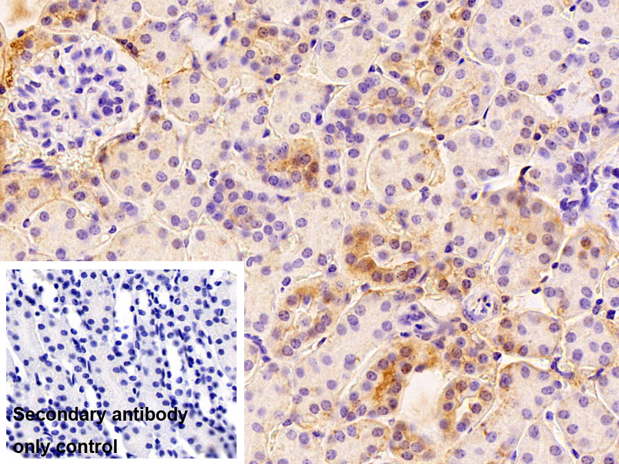 Polyclonal Antibody to Death receptor 5 (DR5)