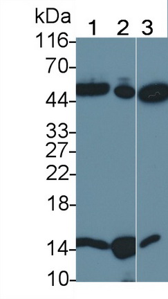 Polyclonal Antibody to Death receptor 5 (DR5)