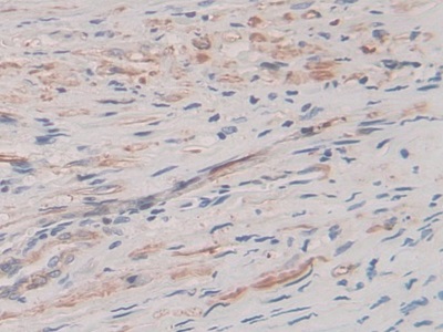 Polyclonal Antibody to Parathyroid Hormone Related Protein (PTHrP)