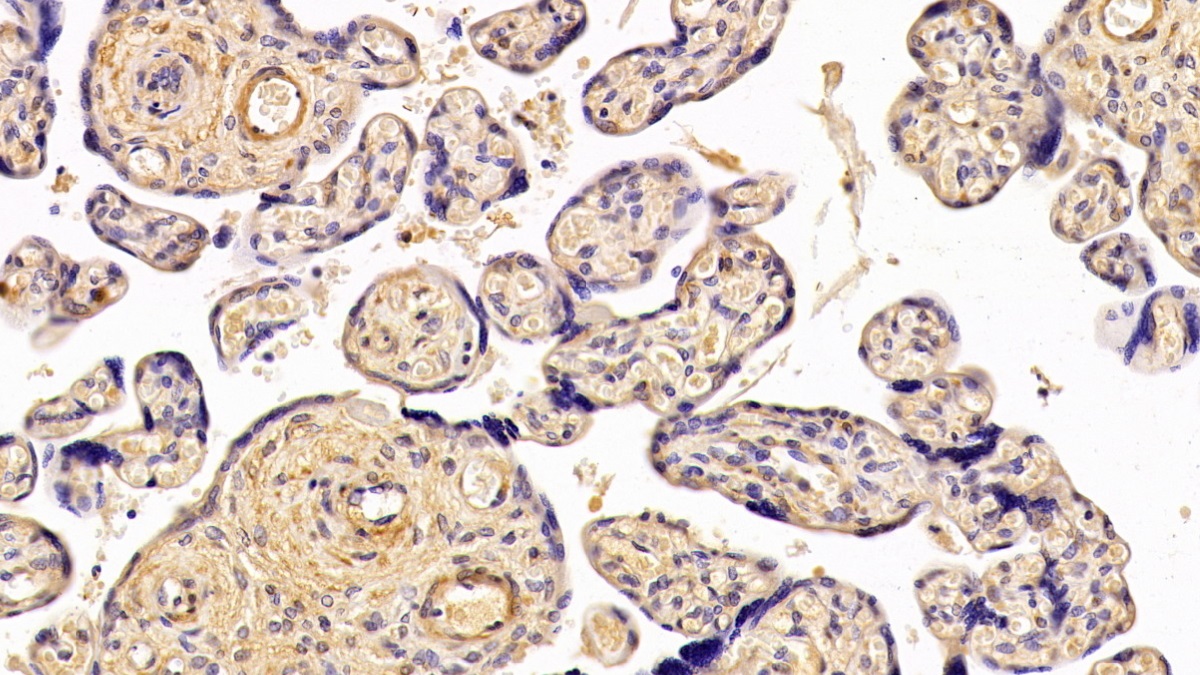 Polyclonal Antibody to Parathyroid Hormone Related Protein (PTHrP)