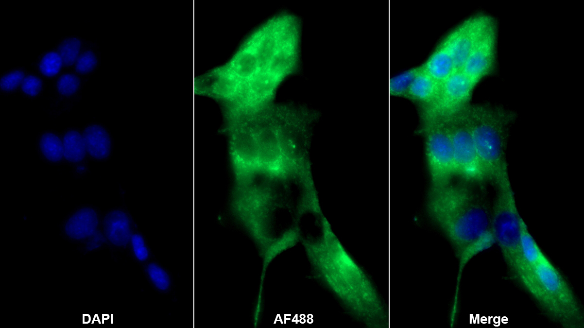 Polyclonal Antibody to Coagulation Factor II (F2)