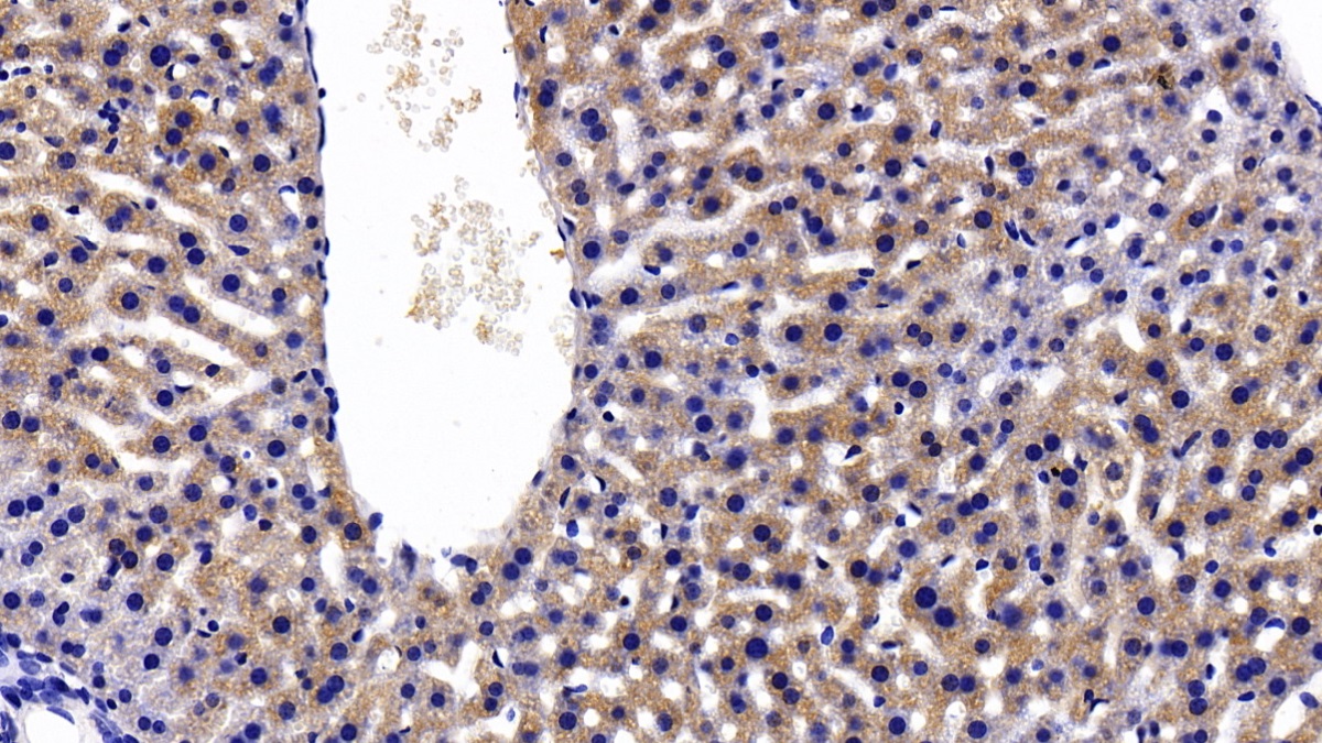 Polyclonal Antibody to C Reactive Protein (CRP)