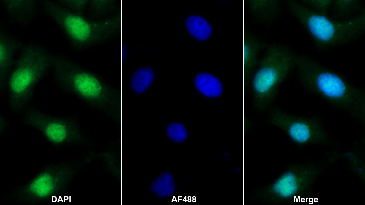 Polyclonal Antibody to C Reactive Protein (CRP)