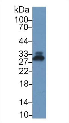 Polyclonal Antibody to C Reactive Protein (CRP)