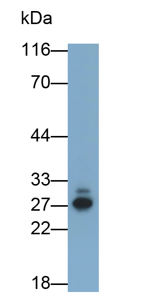Polyclonal Antibody to C Reactive Protein (CRP)