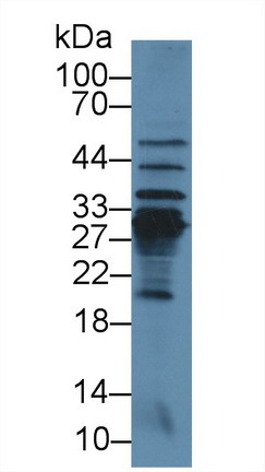 Polyclonal Antibody to C Reactive Protein (CRP)