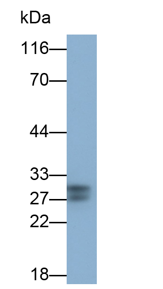 Polyclonal Antibody to C Reactive Protein (CRP)