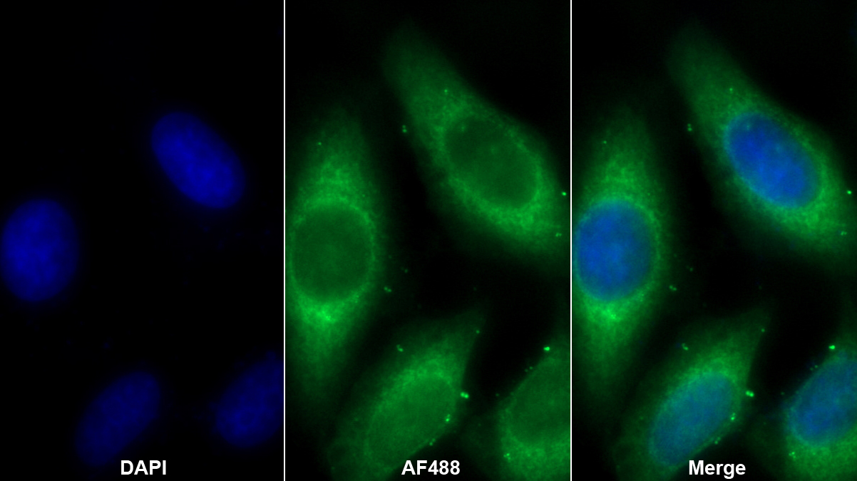 Polyclonal Antibody to Heat Shock Protein 90kDa Beta 1 (HSP90b1)