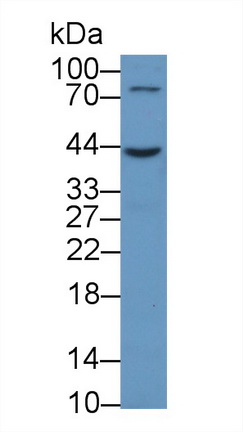 Polyclonal Antibody to Cluster Of Differentiation 86 (CD86)