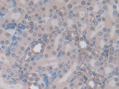 Polyclonal Antibody to Tumor Necrosis Factor Ligand Superfamily, Member 14 (TNFSF14)