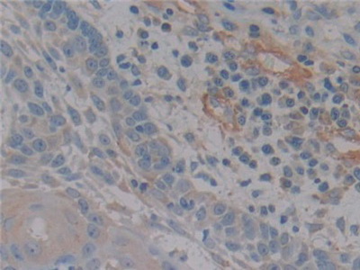 Polyclonal Antibody to Nitric Oxide Synthase 2, Inducible (NOS2)