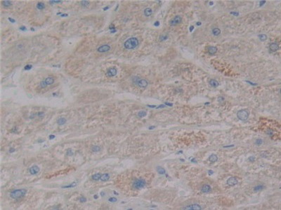 Polyclonal Antibody to Nitric Oxide Synthase 2, Inducible (NOS2)