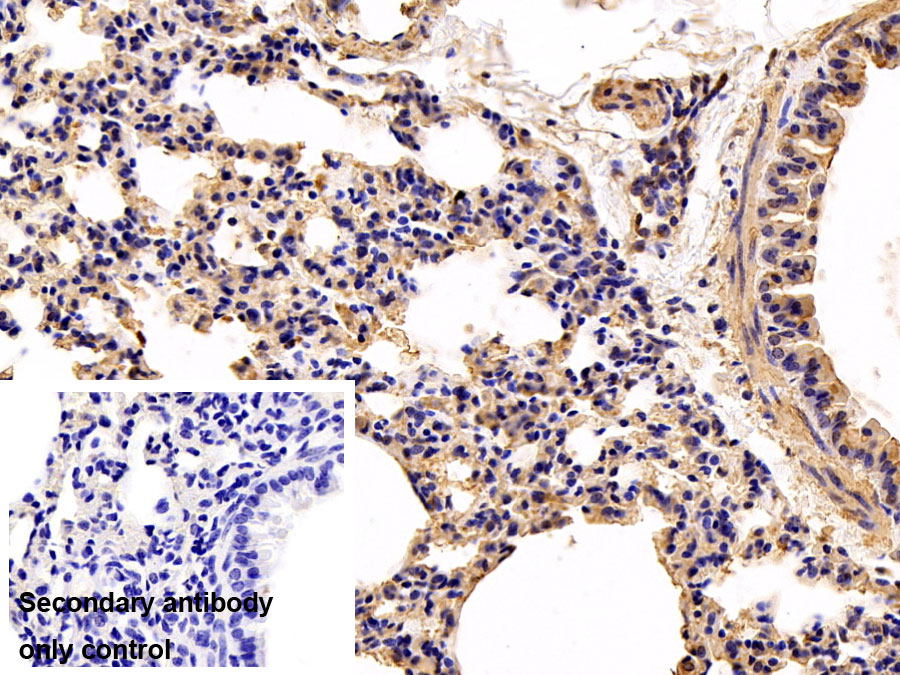 Polyclonal Antibody to Nitric Oxide Synthase 2, Inducible (NOS2)