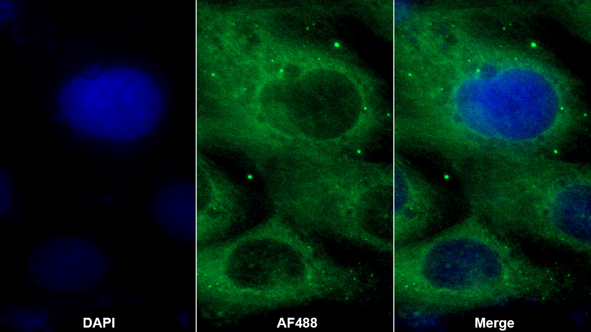 Polyclonal Antibody to Nitric Oxide Synthase 2, Inducible (NOS2)