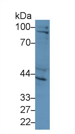 Polyclonal Antibody to Inhibin Beta A (INHbA)