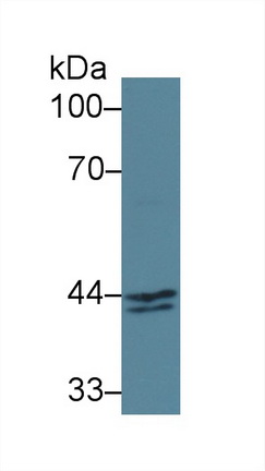 Polyclonal Antibody to Inhibin Beta A (INHbA)