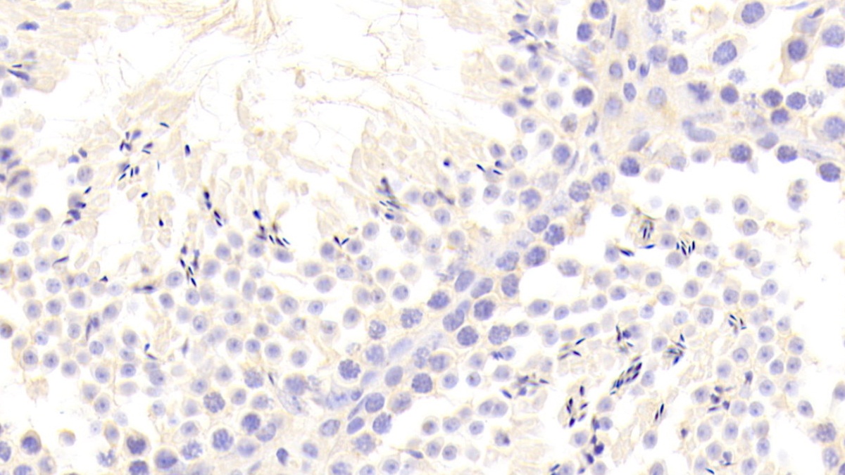 Polyclonal Antibody to Von Willebrand Factor A Domain Containing Protein 1 (vWA1)