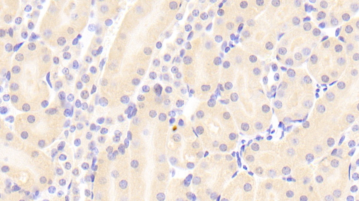 Polyclonal Antibody to Von Willebrand Factor A Domain Containing Protein 1 (vWA1)