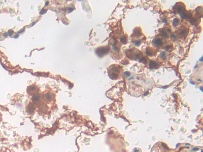 Polyclonal Antibody to Glycogen Phosphorylase, Liver (PYGL)