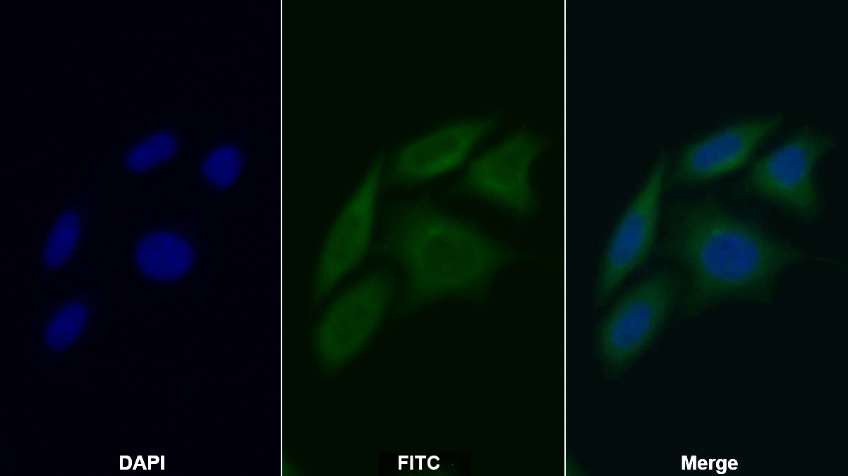 Polyclonal Antibody to Caspase 8 (CASP8)