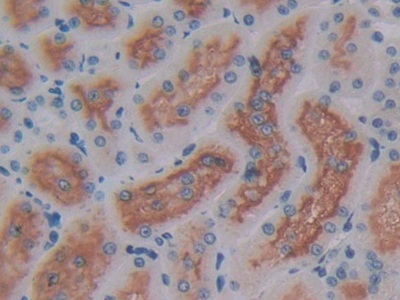 Polyclonal Antibody to Aminopeptidase A (ENPEP)