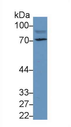 Polyclonal Antibody to Mannose Associated Serine Protease 2 (MASP2)