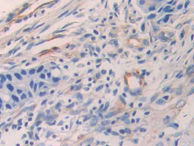 Polyclonal Antibody to Epithelial Neutrophil Activating Peptide 78 (ENA78)
