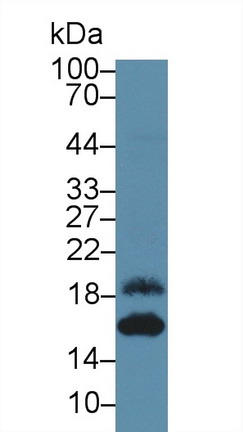 Polyclonal Antibody to Epithelial Neutrophil Activating Peptide 78 (ENA78)