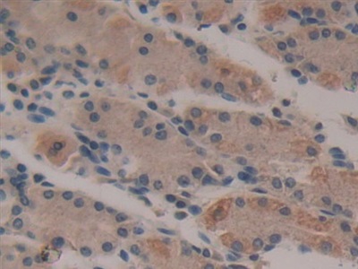 Polyclonal Antibody to Epithelial Neutrophil Activating Peptide 78 (ENA78)