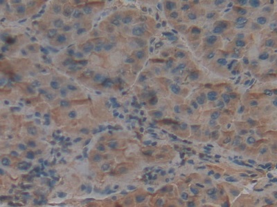 Polyclonal Antibody to Complement Component 3 (C3)