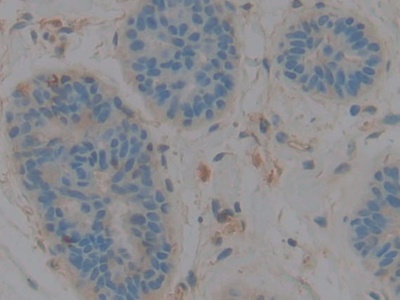 Polyclonal Antibody to Complement Component 3 (C3)