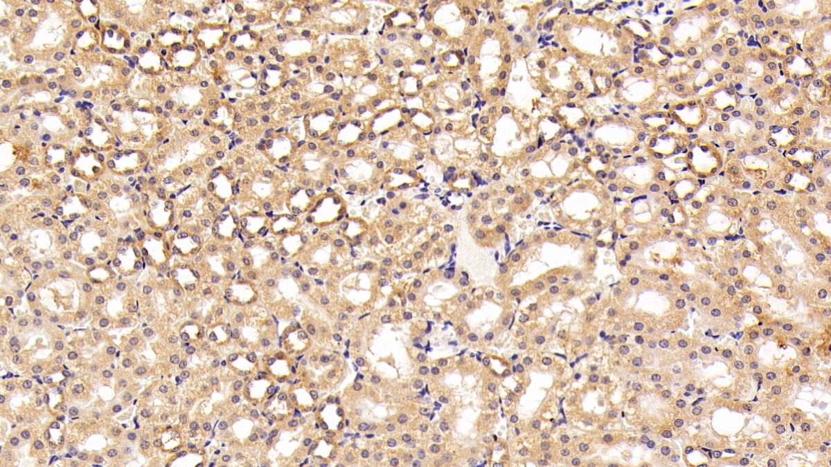 Polyclonal Antibody to Endothelial NOS (eNOS)
