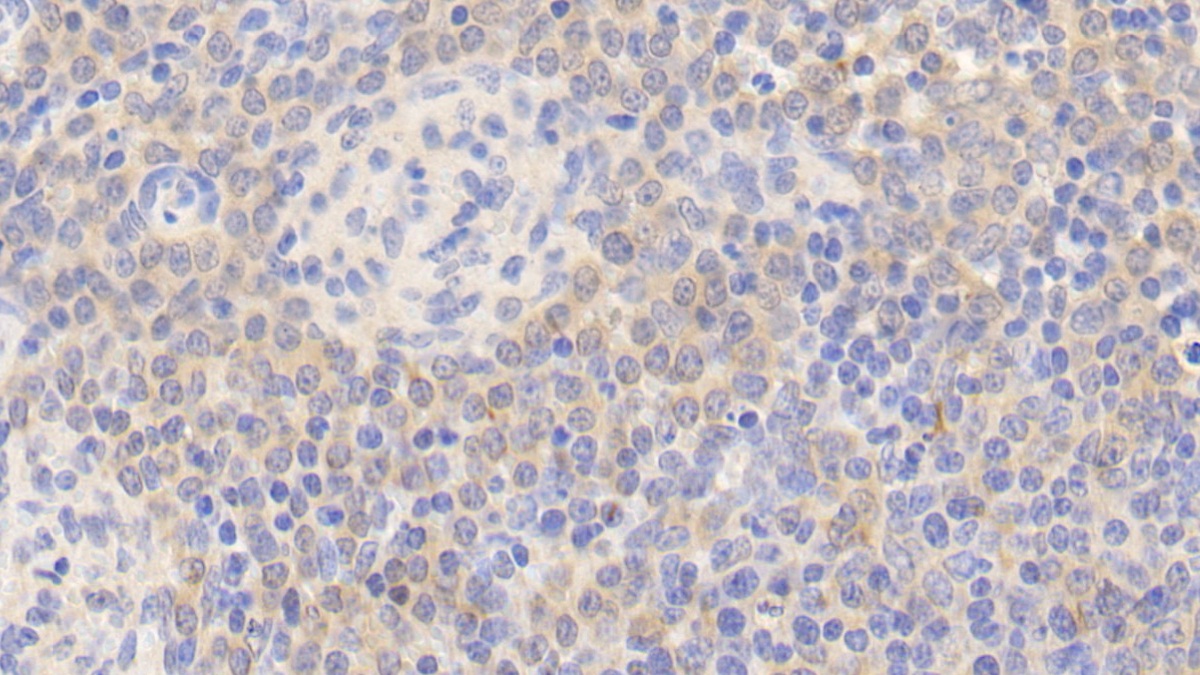 Polyclonal Antibody to Endothelial NOS (eNOS)