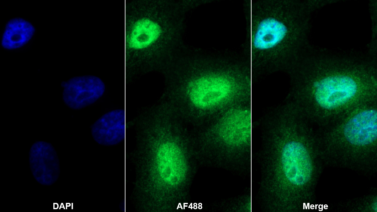 Polyclonal Antibody to Heat Shock Protein 40 (HSP40)