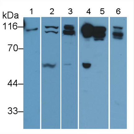 Polyclonal Antibody to Cluster Of Differentiation 26 (CD26)