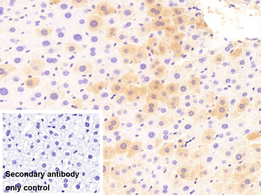 Polyclonal Antibody to Serum Amyloid A (SAA)