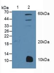 Polyclonal Antibody to Peroxisome Proliferator Activated Receptor Gamma (PPARg)