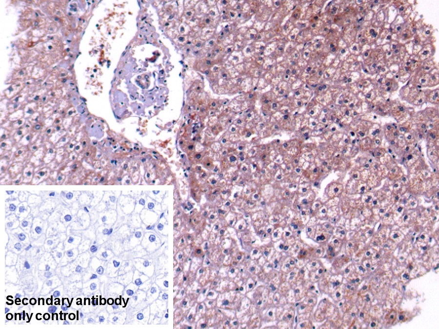 Polyclonal Antibody to Complement Component 4 (C4)