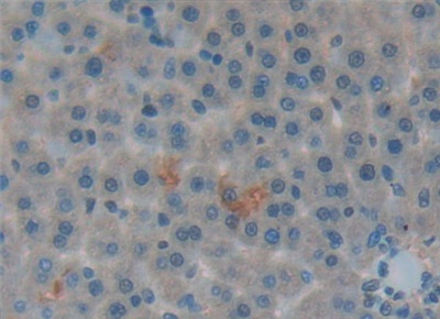Polyclonal Antibody to Pulmonary Surfactant Associated Protein A1 (SFTPA1)