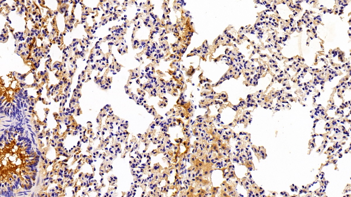 Polyclonal Antibody to Arachidonate-15-Lipoxygenase (ALOX15)