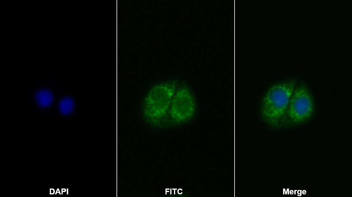 Polyclonal Antibody to Insulin Receptor (INSR)